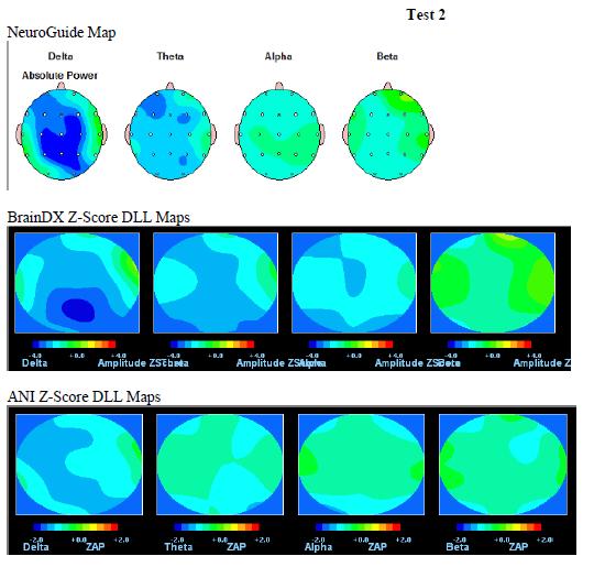 2.0] Difference Between Mapping And Scoring