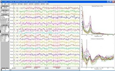 neuroguide